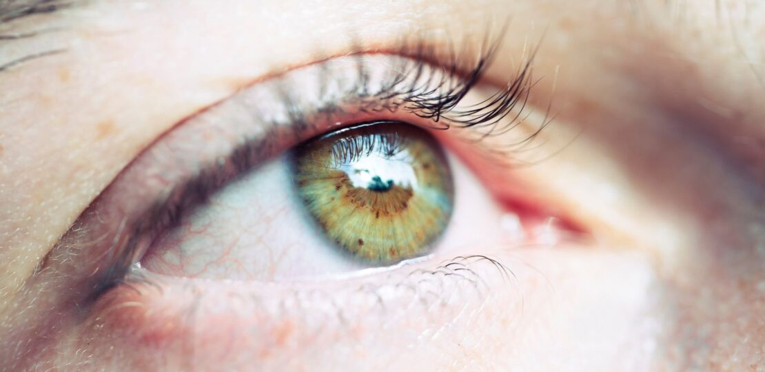 eyelid-surgery-what-you-need-to-know-featured